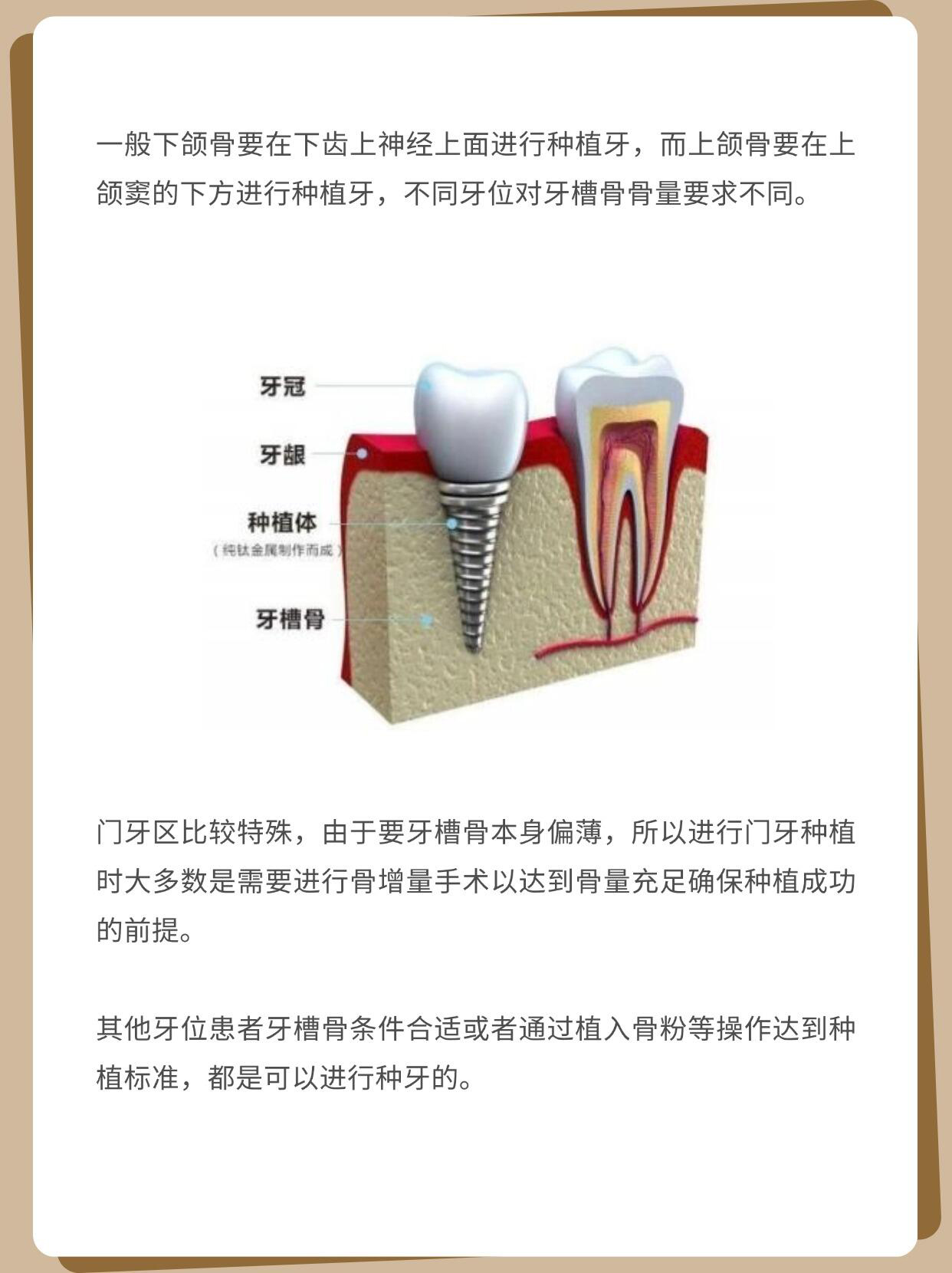 團(tuán)購(gòu)活動(dòng)：性價(jià)比之選