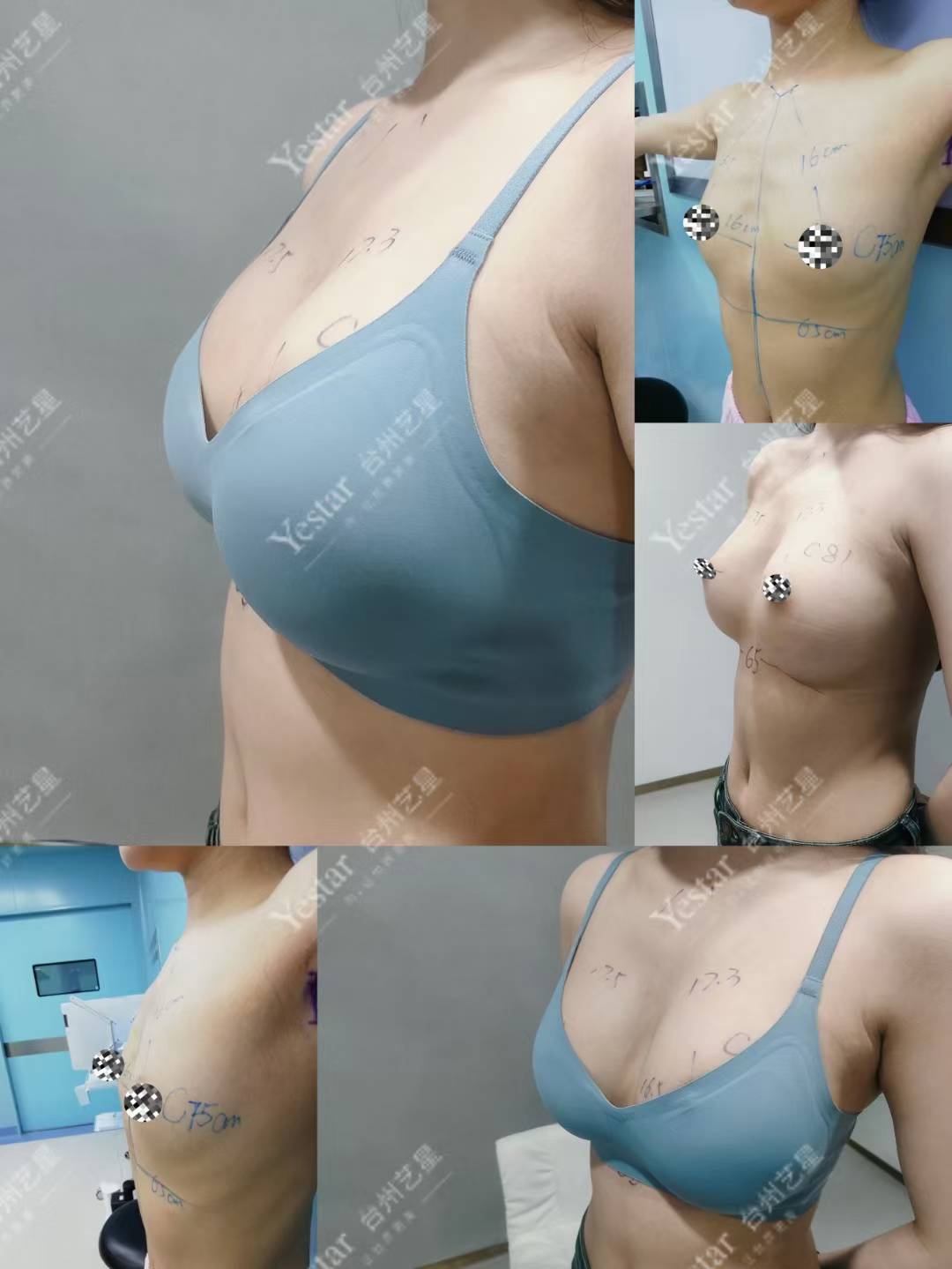 東莞光明眼科私立可線上預約肖遲劉永民醫(yī)生，全飛秒17000元起享優(yōu)質診療！ 