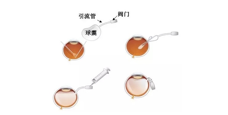 背靠中山眼科的東莞光明眼科有啥優(yōu)勢(shì)？