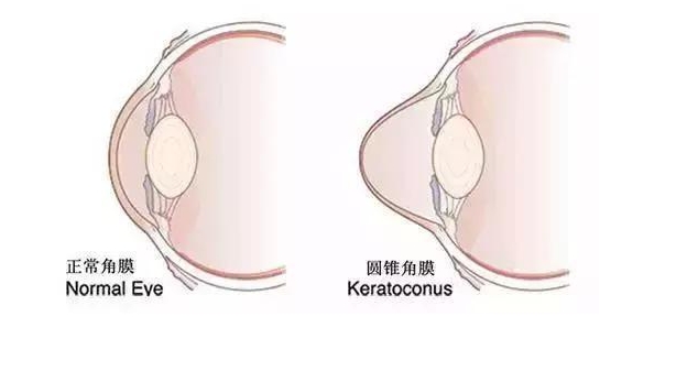 東莞光明眼科的白內(nèi)障專(zhuān)科水平如何？