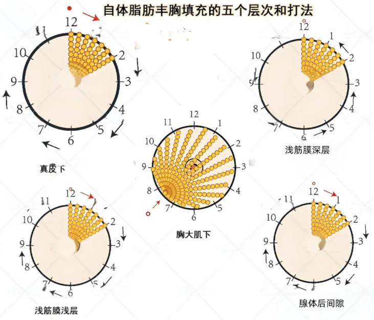 2026董巖巖北京隆胸價(jià)格表