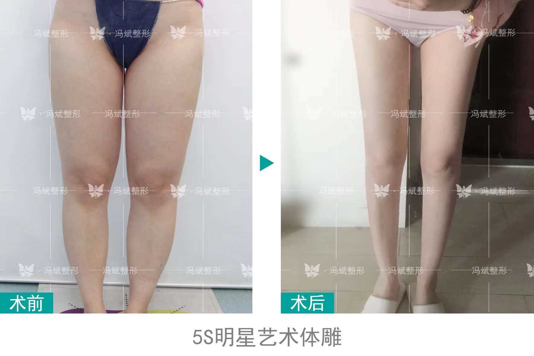 馮斌脂雕各部位價(jià)格表