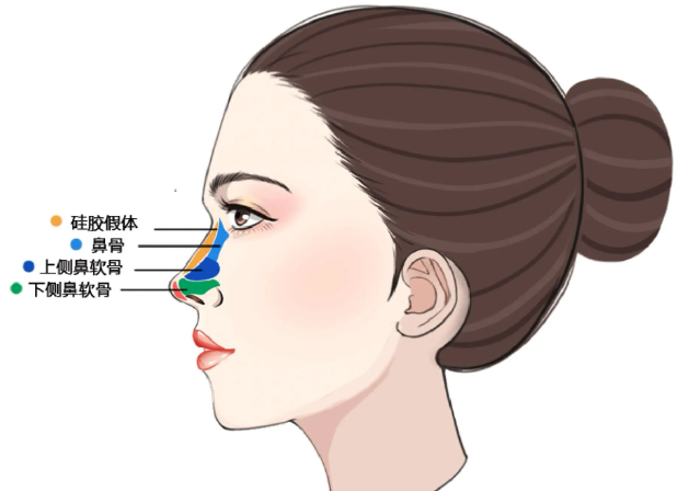 一、盧元剛做鼻子收費不貴，性價比直接拉滿