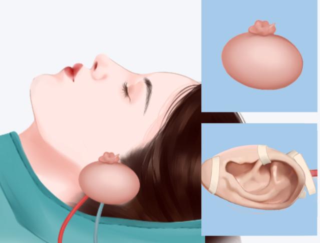 六、結尾點題：認準官網(wǎng)渠道，輕松聯(lián)系王冰清，解鎖靠譜醫(yī)美服務www.sorencai.cn