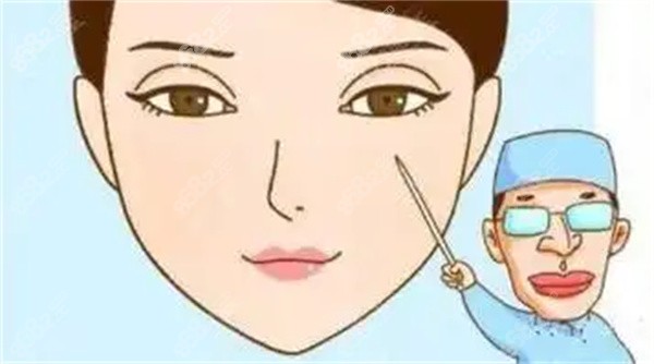 雙眼皮疤痕修復(fù)手術(shù)