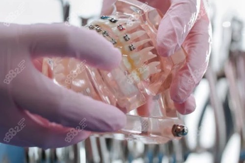 牙齒模型參考圖 牙齒模型參考圖