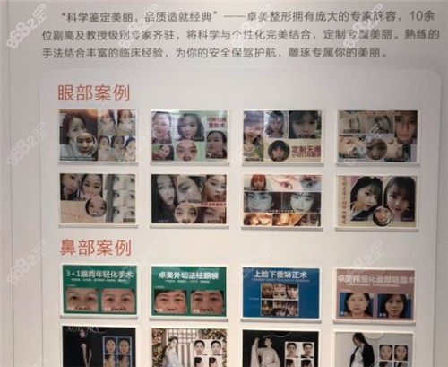 武漢硚口卓美整形展示墻