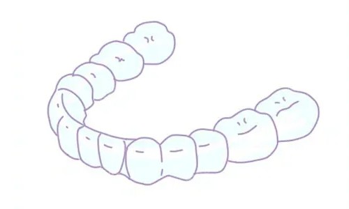 上海閔行區(qū)牙齒矯正多少錢(qián)？含2026隱形矯正、金屬正畸項(xiàng)目費(fèi)用匯總