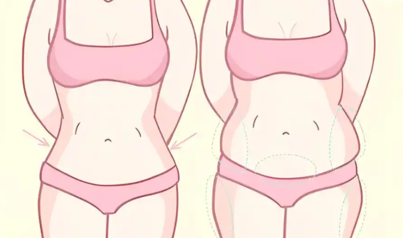 夏學(xué)穎醫(yī)生產(chǎn)后腹壁修復(fù)實(shí)例解析