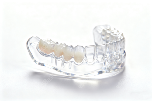 時(shí)代天使隱形矯正展示圖