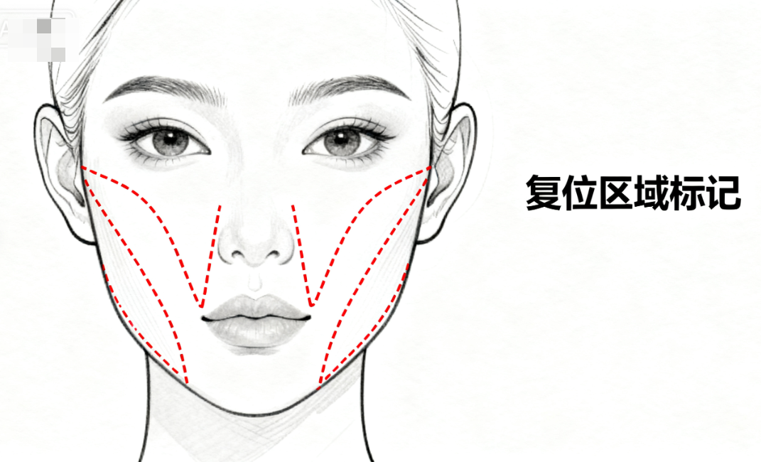 三、陳建忠內(nèi)窺鏡額頭提升適合哪些人？