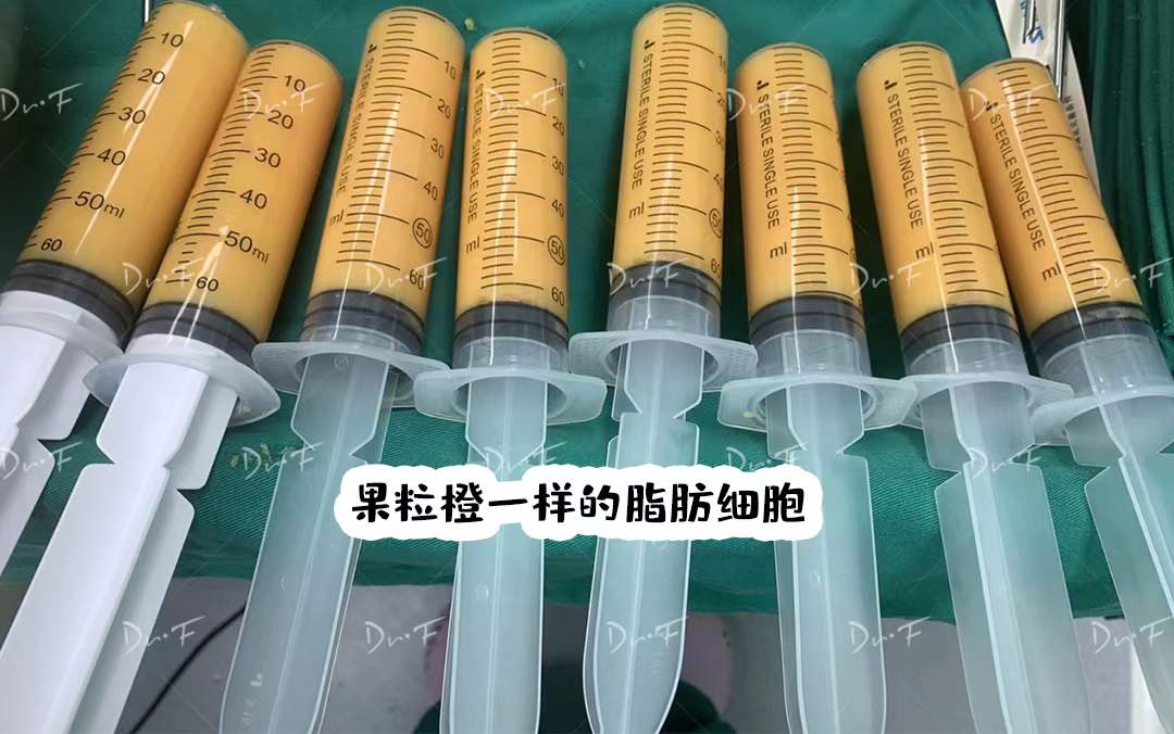 真實實例見證，馮斌脂雕塑美實力