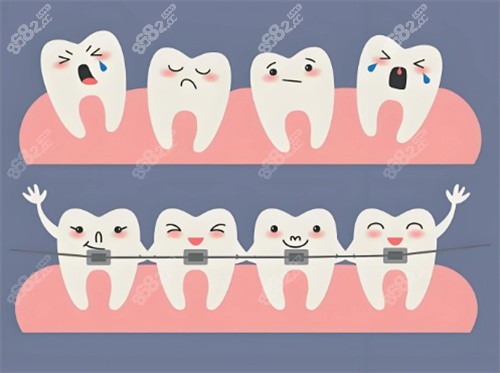 牙齒矯正卡通展示