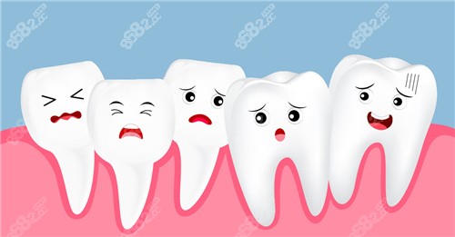 牙齒擁擠動(dòng)畫圖