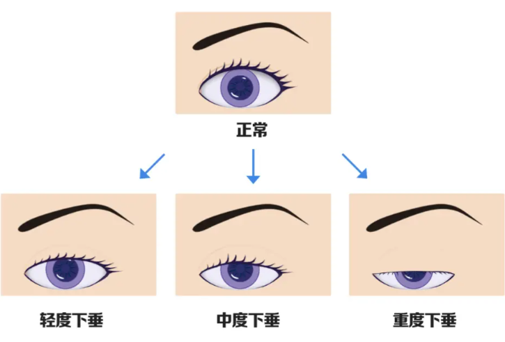 真實(shí)范例與成效：見(jiàn)證蛻變故事