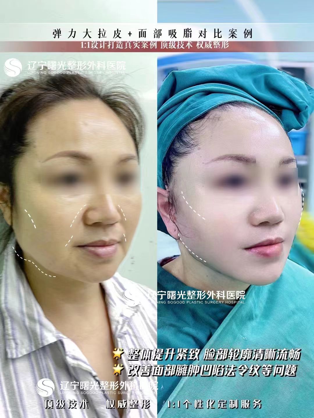 于世川：無(wú)痕自然派