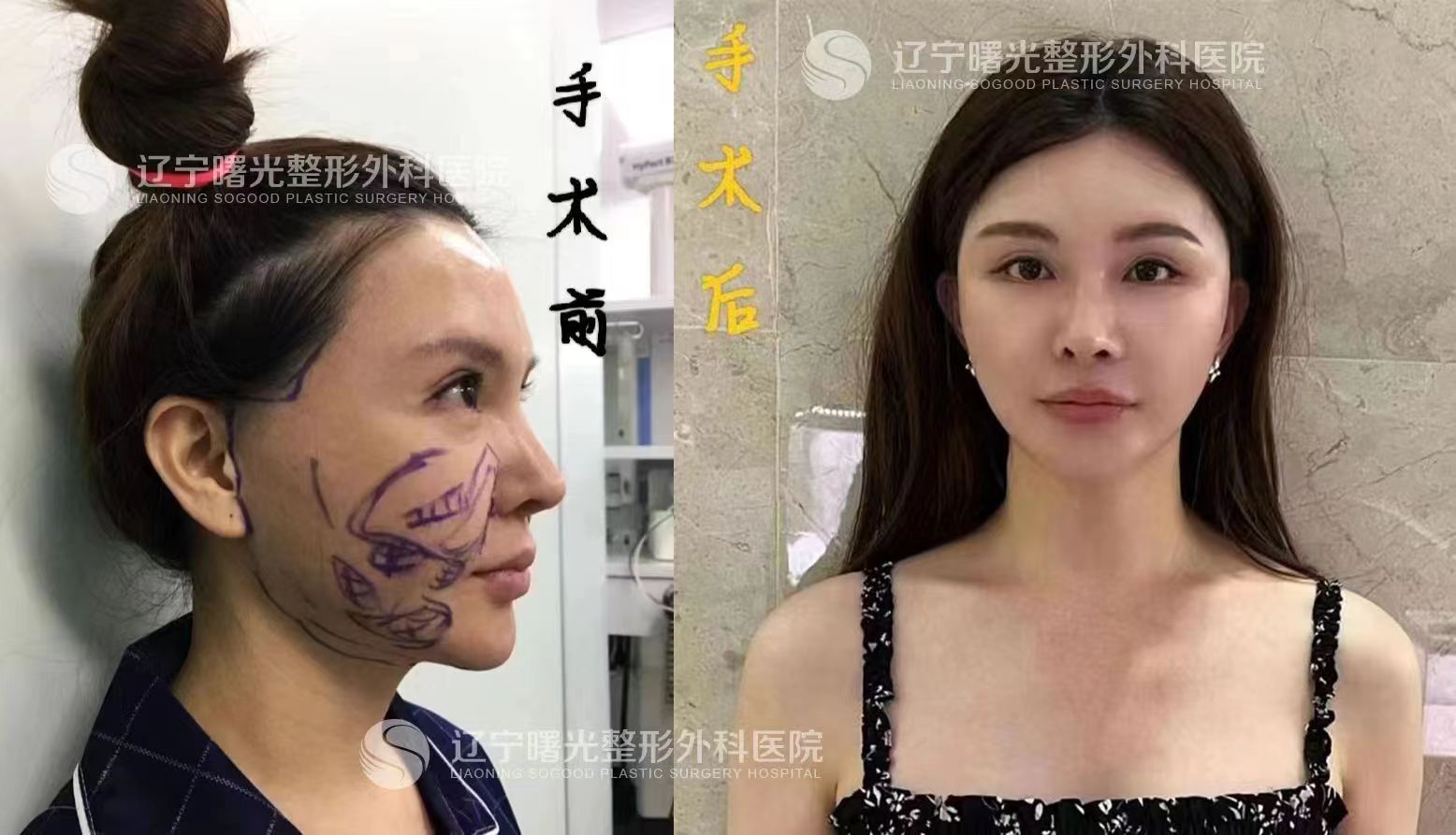 崔昌墉和于世川所在醫(yī)院情況