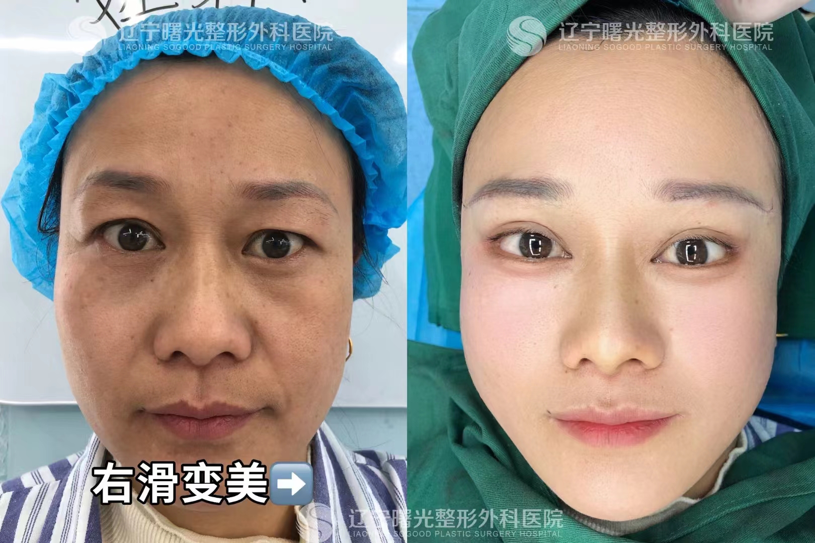 如何選擇崔昌墉和于世川