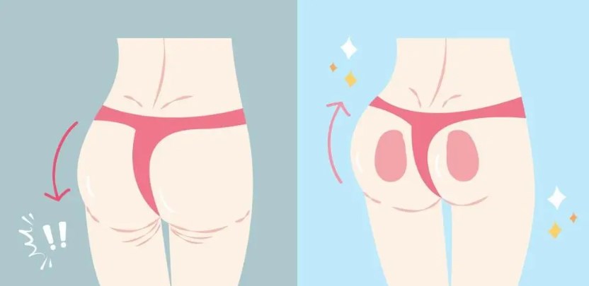 二、北京公辦醫(yī)院整形美容外科臀部塑形技術(shù)