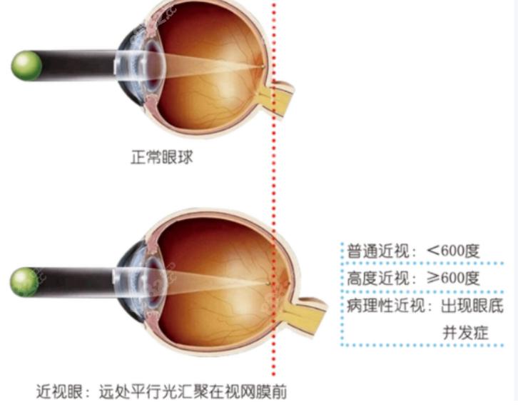 四、如何選擇適合您做和家歐共莫加固術(shù)的就診地點(diǎn)？