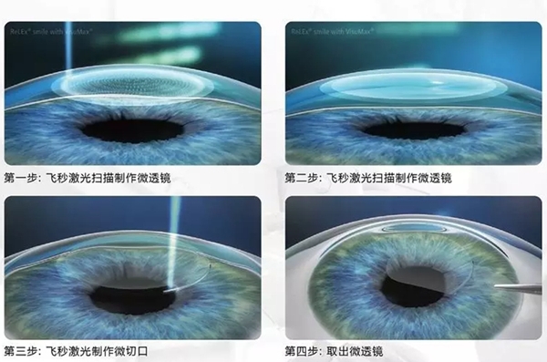 2. 專家團隊坐鎮(zhèn)，手術(shù)親診親做