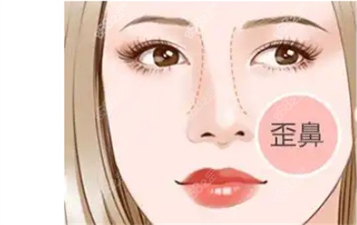 南京鼻修復看康美馮思陽：資質(zhì)硬、技術(shù)專、審美自然、口碑穩(wěn)、價格透明