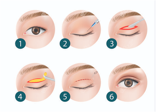 沈陽(yáng)雙眼皮醫(yī)院排行榜2026版：名流、元辰、杏林等10家名院實(shí)力對(duì)比