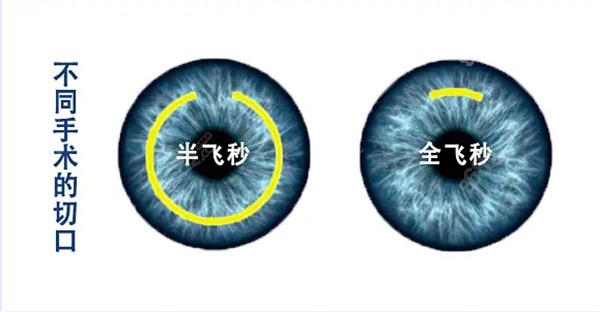 半飛秒和全飛秒?yún)^(qū)別