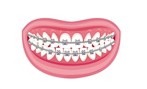 南京六城口腔醫(yī)院是公立還是私立？私立二級口腔?？疲N植正畸特色診療環(huán)境舒適