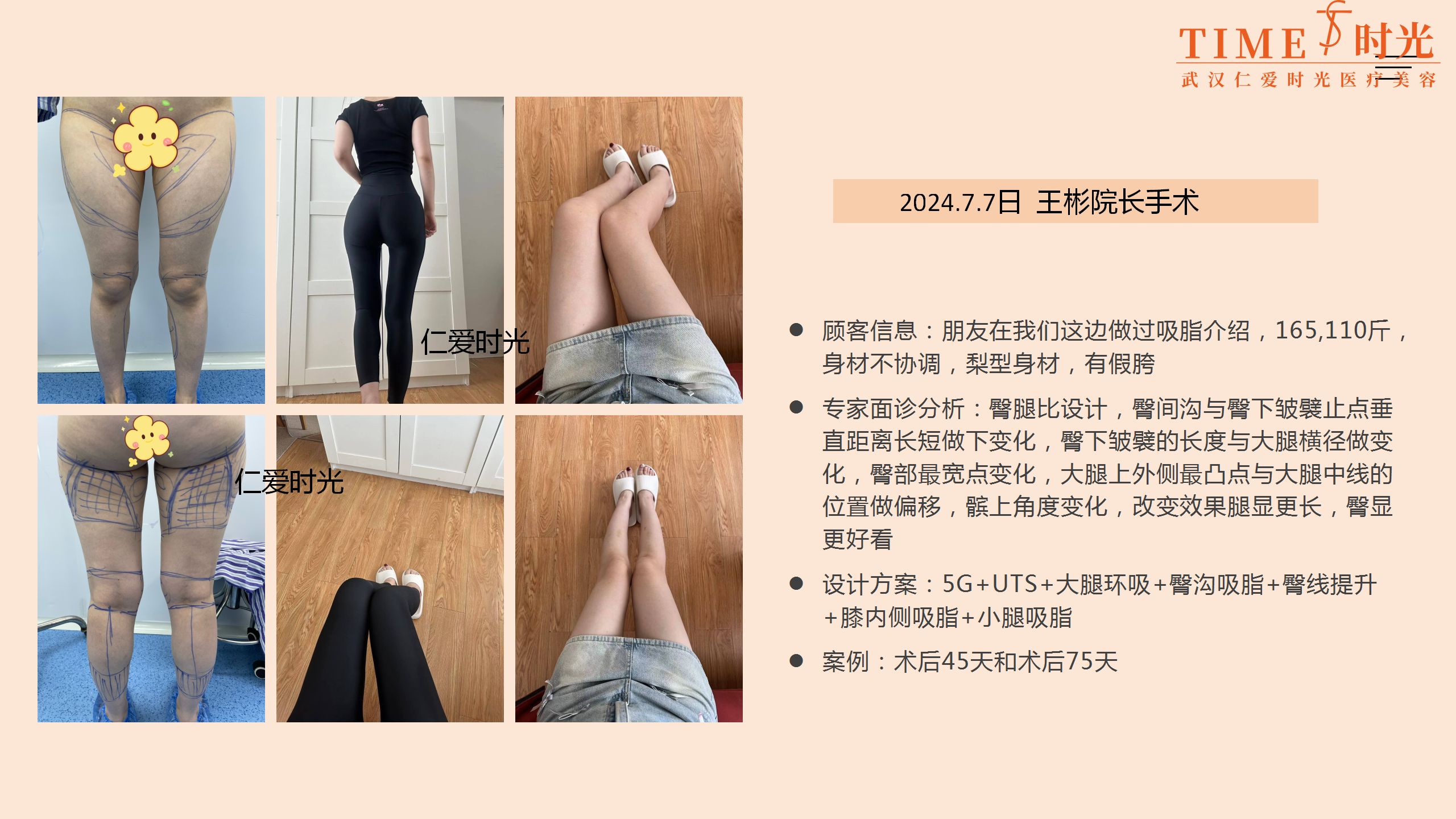 金洪堯醫(yī)生在哪個(gè)醫(yī)院坐診？他在廣州煥新顏醫(yī)療美容，擅吸脂體雕和饅化修復(fù) 