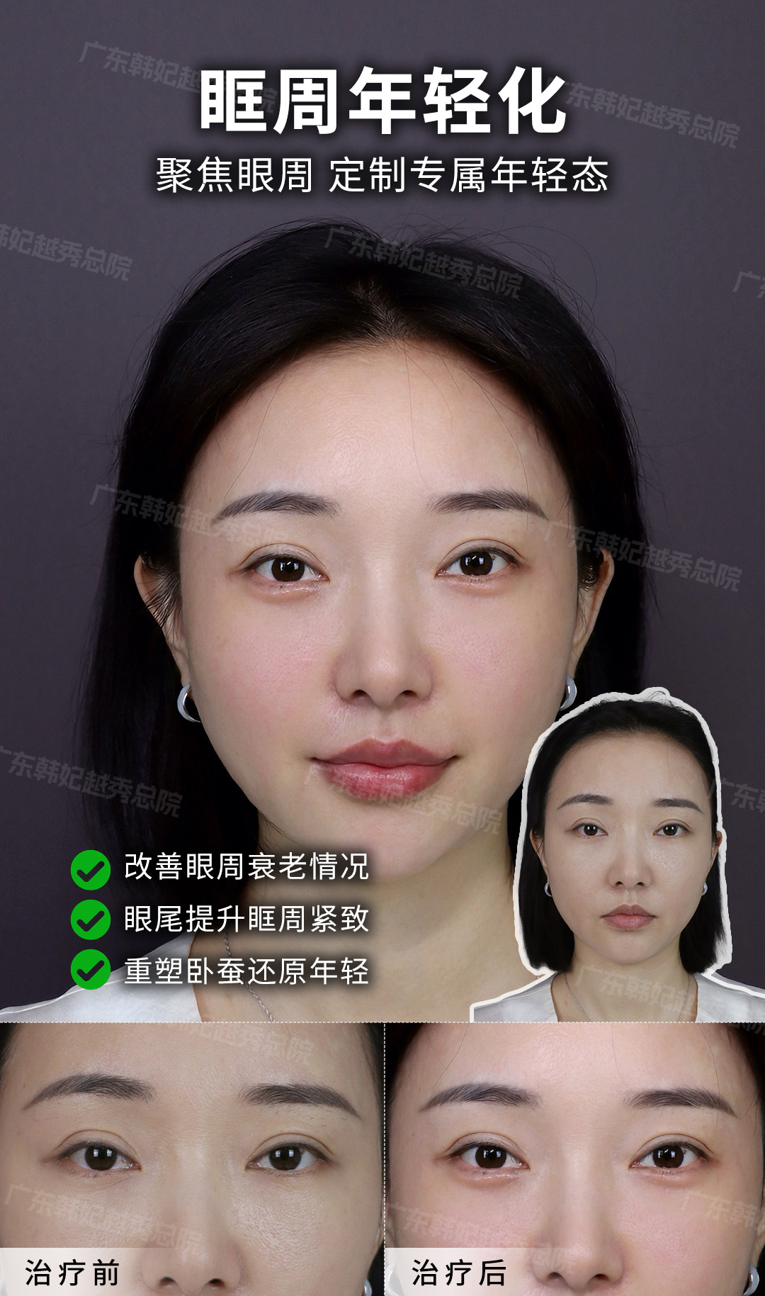 金洪堯醫(yī)生怎么樣？他在廣州煥新顏醫(yī)院，吸脂、饅化修復(fù)技術(shù)強(qiáng)口碑好 