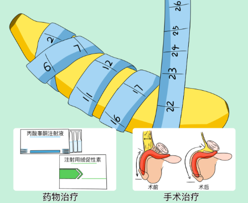 二、 男性假体三件套手术价格国产 vs 进口：为什么差价高达10万？