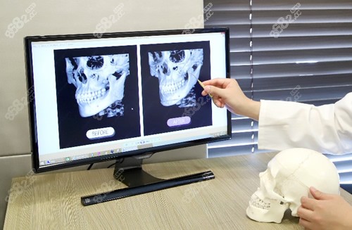 黃大勇醫(yī)生改臉型技術可靠嗎？北京圣嘉新黃大勇下頜角整形真實評價