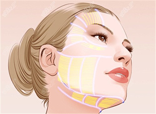 面部拉皮區(qū)域動(dòng)畫(huà)演示圖