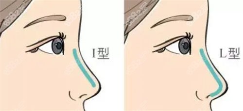 隆鼻不同形態(tài)假體呈現(xiàn)圖