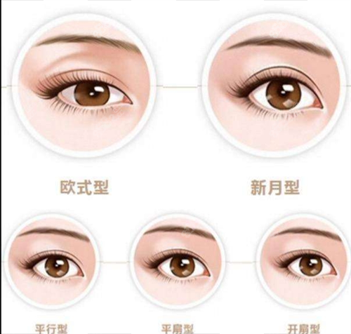 雙眼皮類型圖示