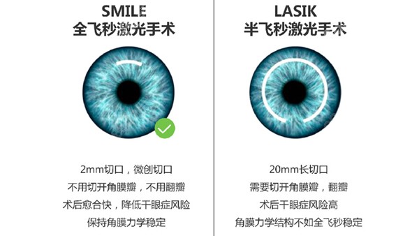 四川華西眼科費(fèi)用一覽表：近視手術(shù)1.2 - 2.5萬元、白內(nèi)障手術(shù)6500 - 80600元、