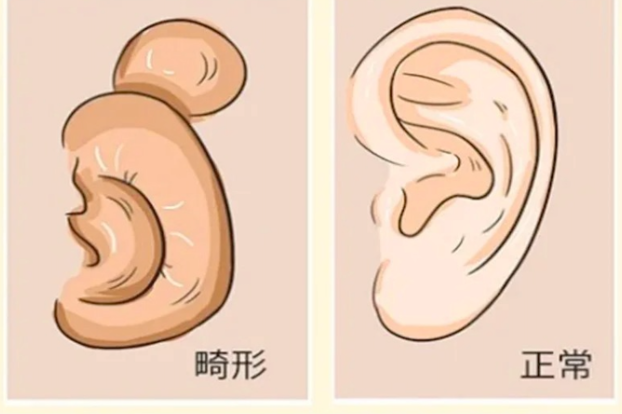 從真實(shí)范例看手術(shù)的顯著成效