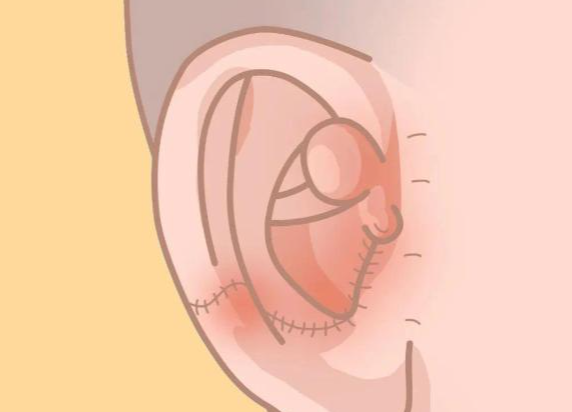 術(shù)后護(hù)理與長(zhǎng)期維持要點(diǎn)