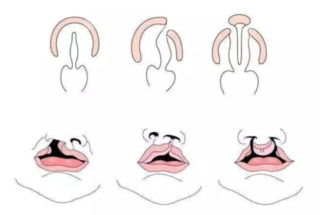 卿勇醫(yī)生在西區(qū)醫(yī)院的優(yōu)勢