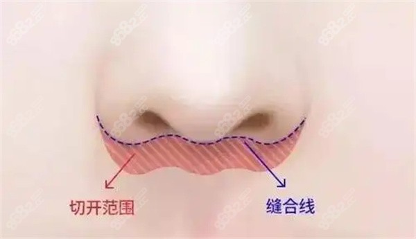 北京王曉健人中縮短多少錢 北京王曉健人中縮短多少錢