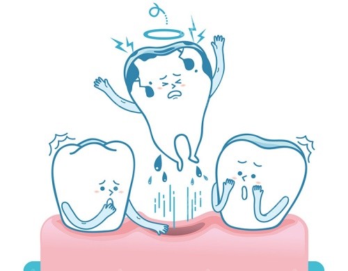 牙齒脫落漫畫示意圖 牙齒脫落漫畫示意圖