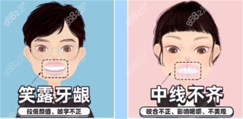 需要矯正的牙齒圖解 需要矯正的牙齒圖解