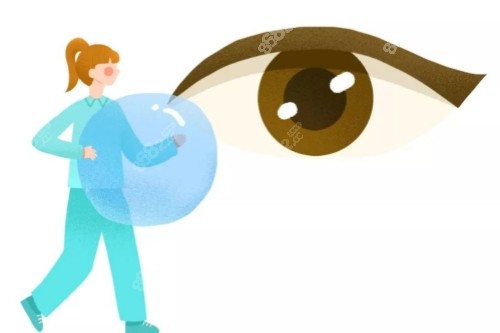 角膜塑形鏡卡通圖 角膜塑形鏡卡通圖