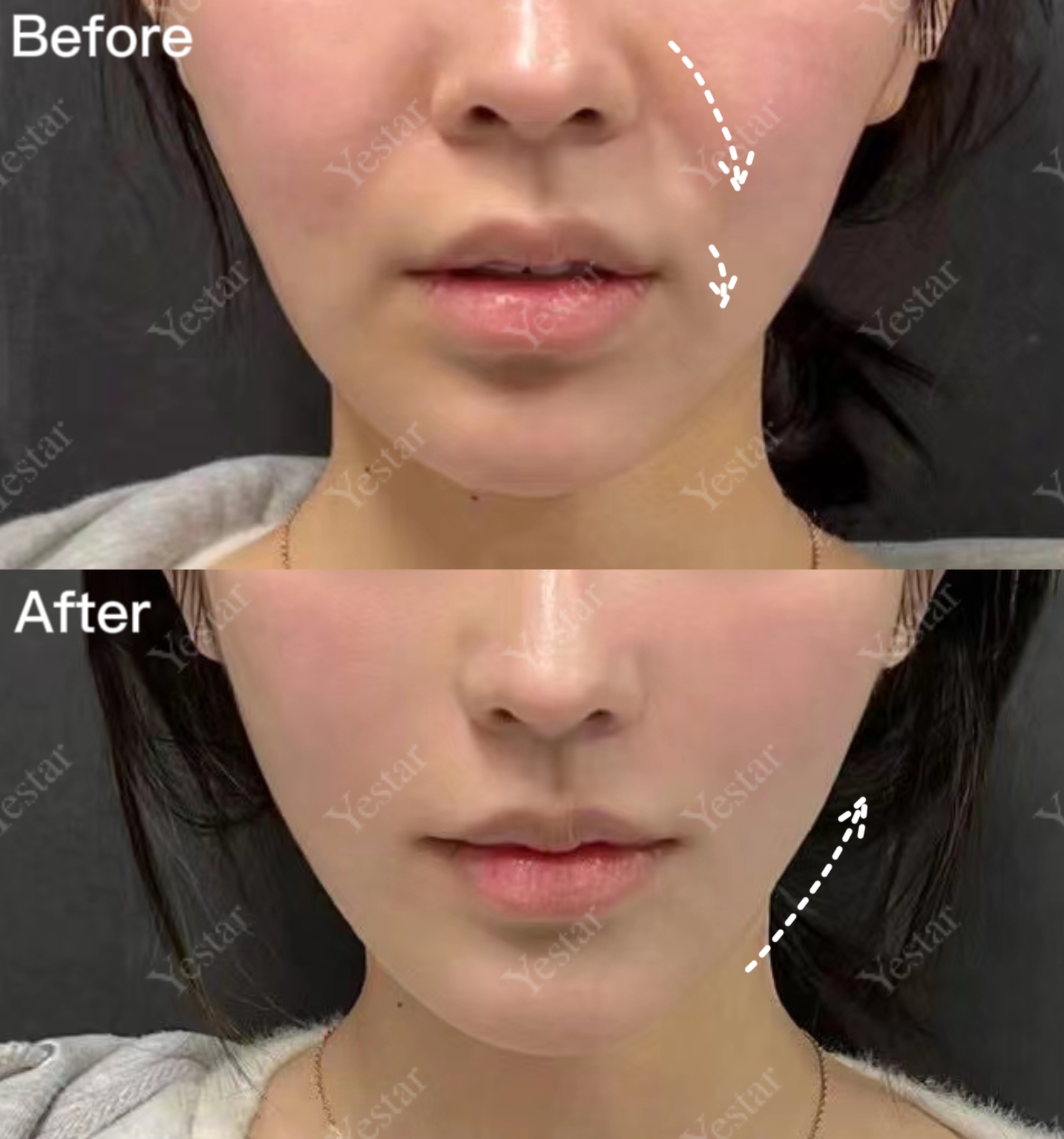 一、譚龍柯醫(yī)生的專精背景與技術(shù)實(shí)力m.sorencai.cn