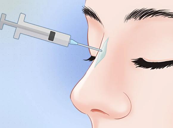 三、楊曉松注射鼻要不要注射費(fèi)：明明白白的消費(fèi)觀