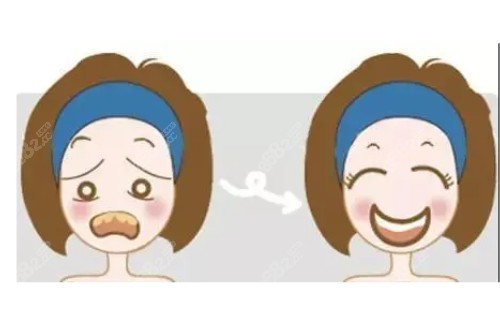 牙齒美白卡通圖片一覽