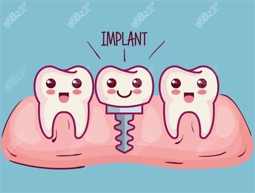 種植牙漫畫示意圖