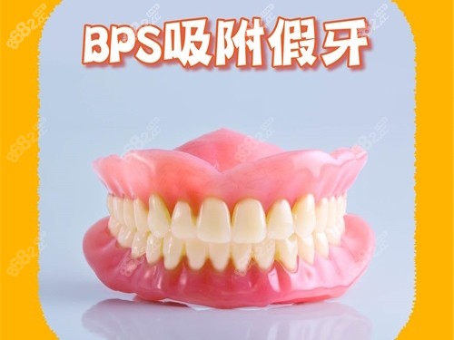 BPS吸附性義齒模型圖