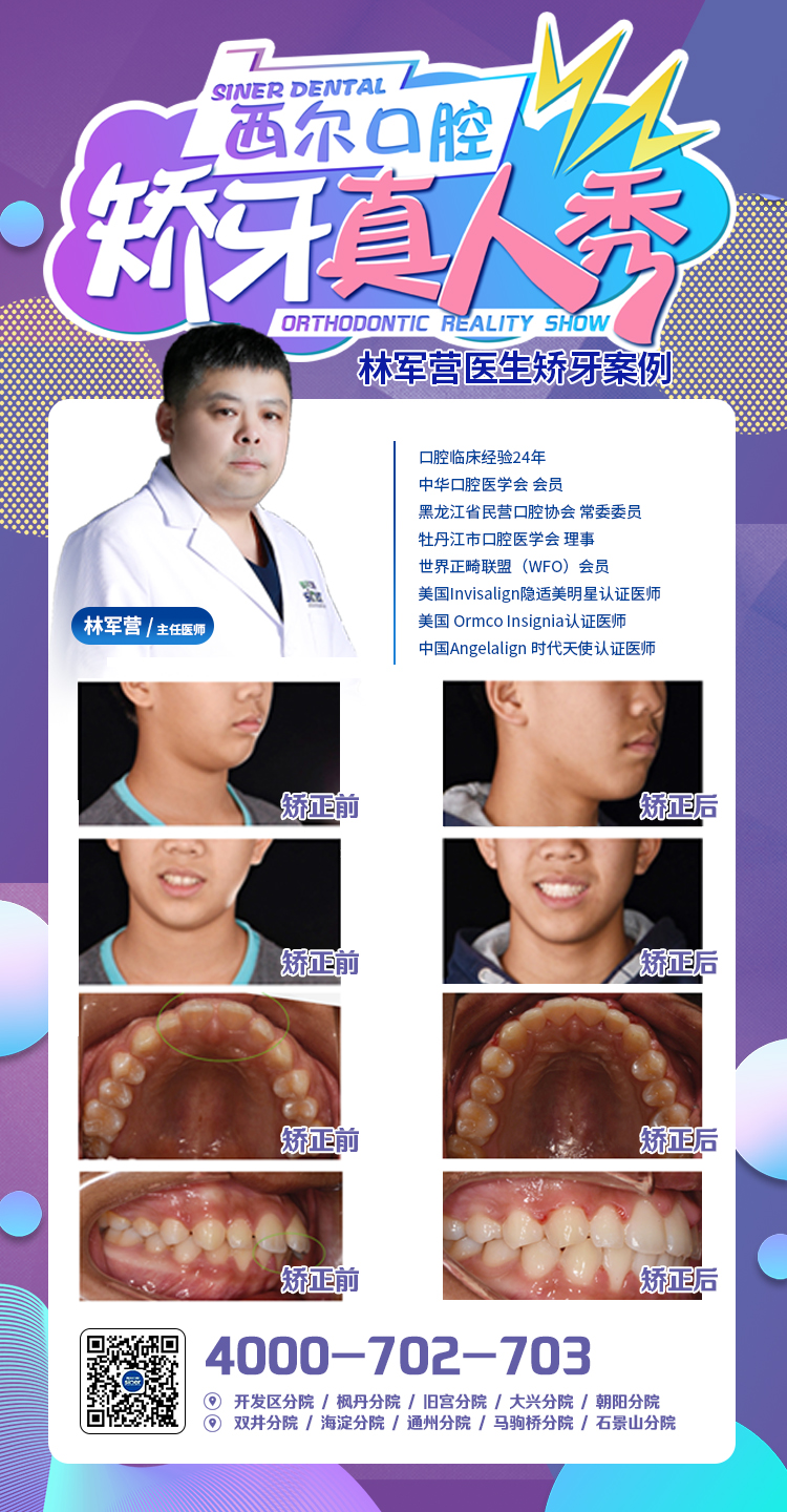 達(dá)芬琪口腔鳳城八路店特色技術(shù)超厲害